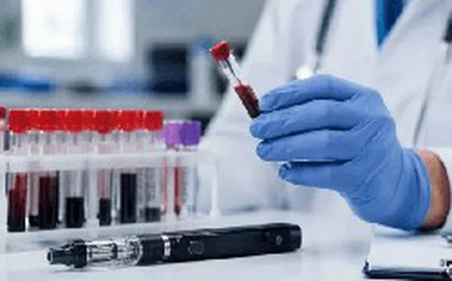 Chưa dừng ở bán thuốc và tiêm chủng, Long Châu tiến sang mảng xét nghiệm, miễn phí lấy mẫu tận nhà